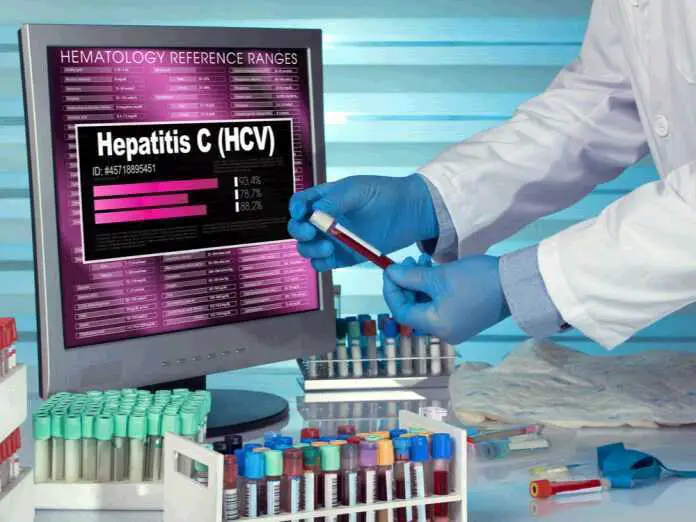 Hepatitis C Tests: What You Need to Know