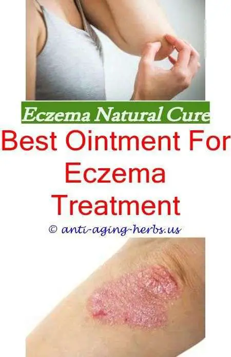 How To Cure Eczema Fast For Babies