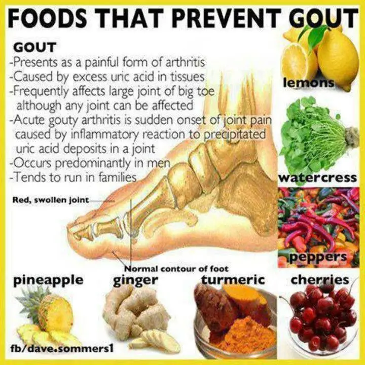 Occurence and prevention of gout: what foods to avoid and which foods ...