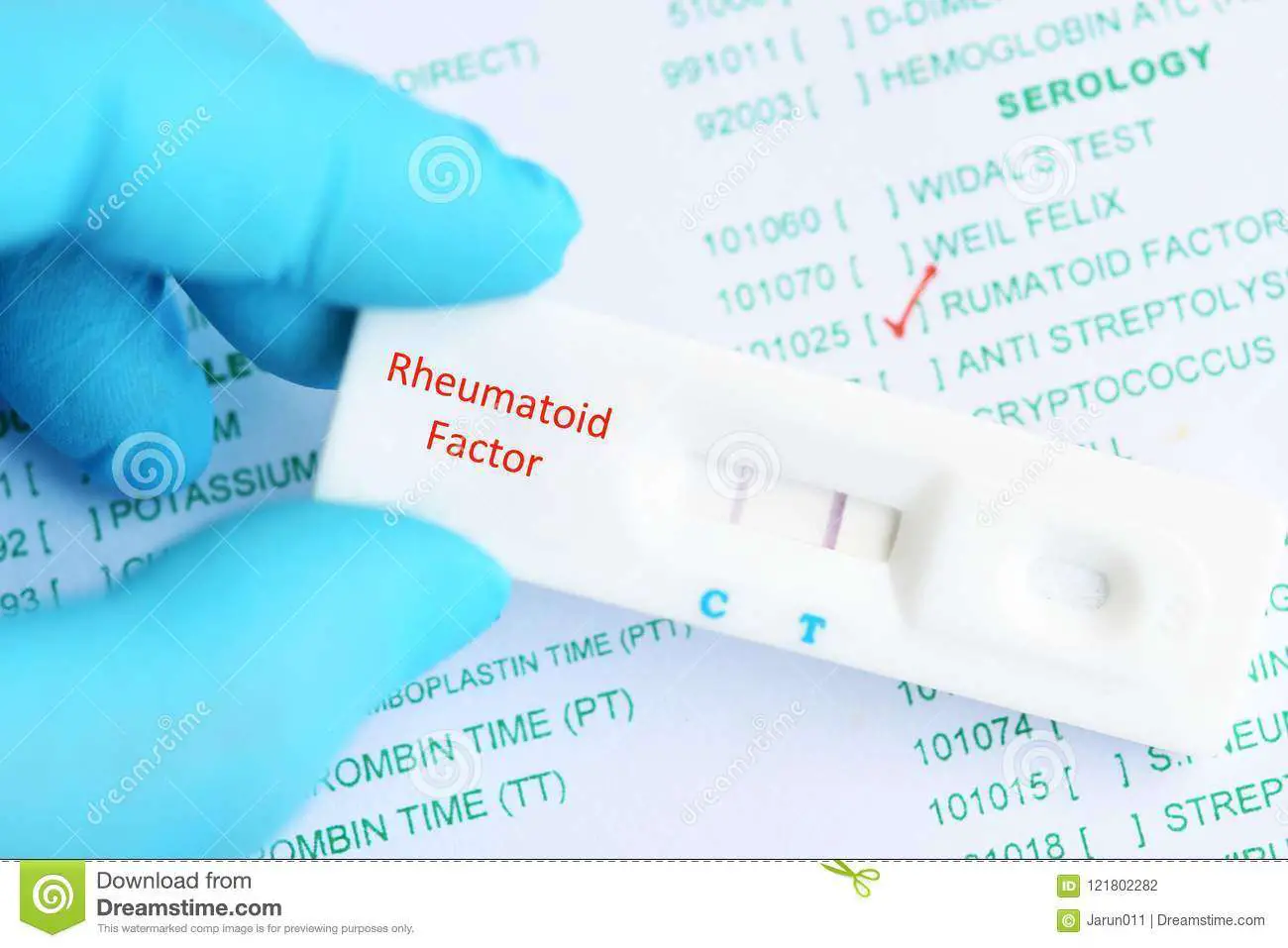 Rheumatoid Factor Positive Test Result Stock Photo